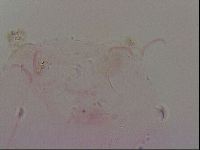 Haplomacrobiotus hermosillensis image