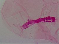 Haplomacrobiotus hermosillensis image