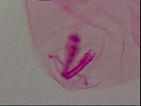 Haplomacrobiotus hermosillensis image