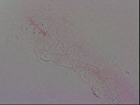 Haplomacrobiotus hermosillensis image