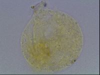 Haplomacrobiotus hermosillensis image