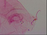 Haplomacrobiotus hermosillensis image