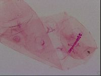 Haplomacrobiotus hermosillensis image