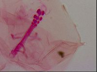 Haplomacrobiotus hermosillensis image