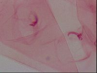 Haplomacrobiotus hermosillensis image