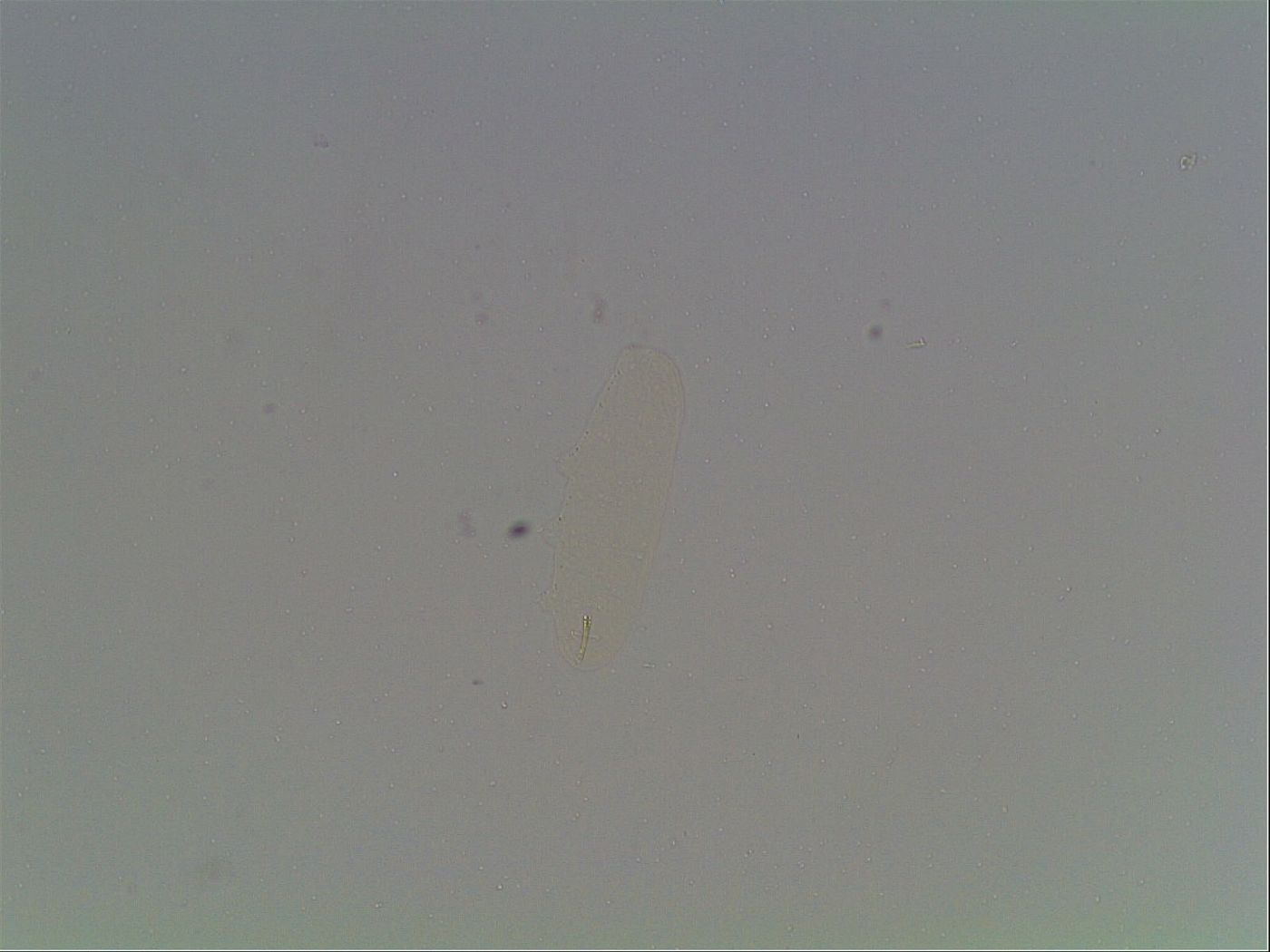 Hexapodibius pseudomicronyx image