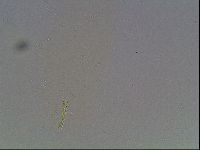 Hexapodibius pseudomicronyx image