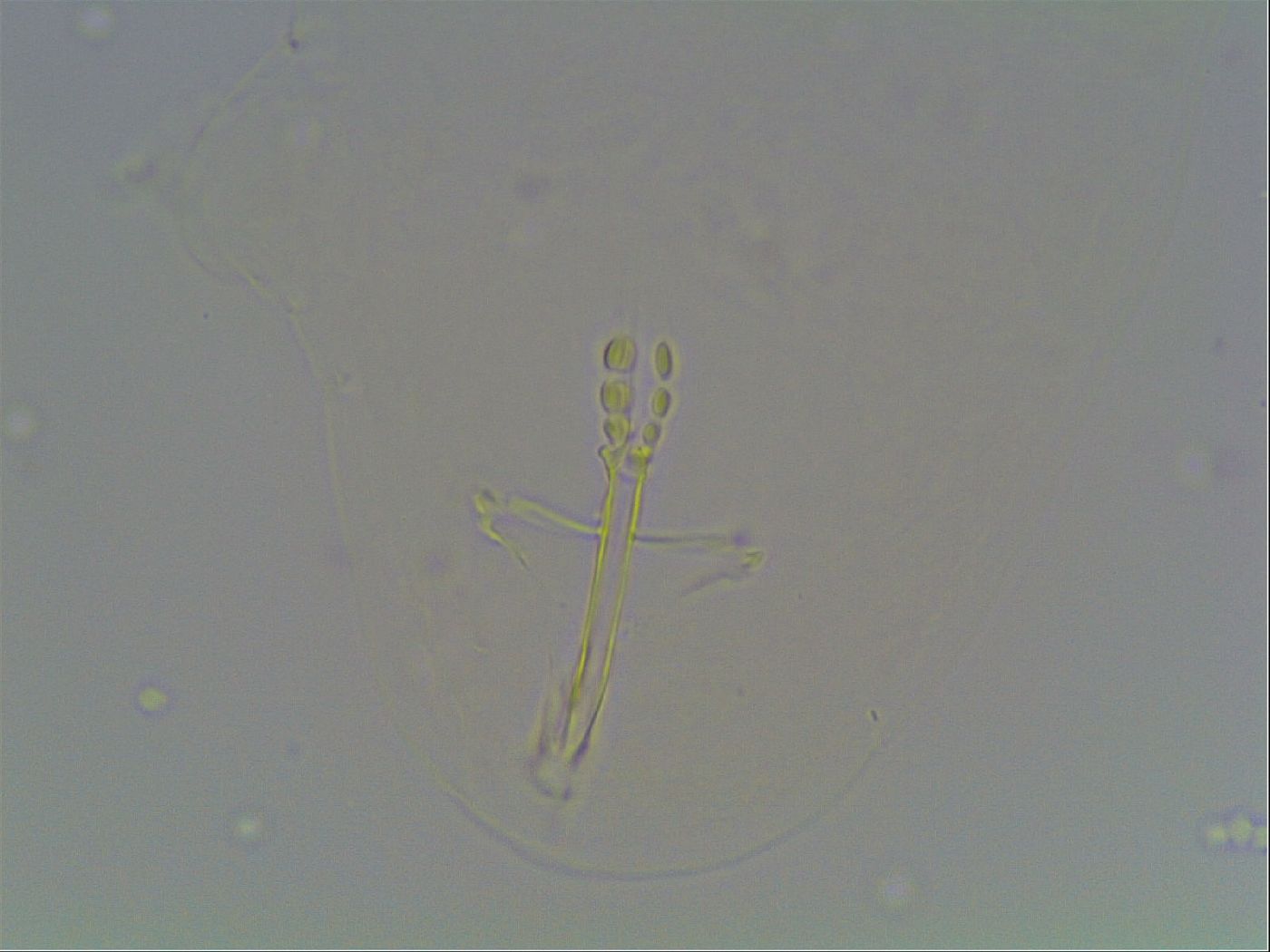 Hexapodibius pseudomicronyx image