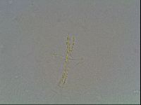 Media resource of Hexapodibius pseudomicronyx