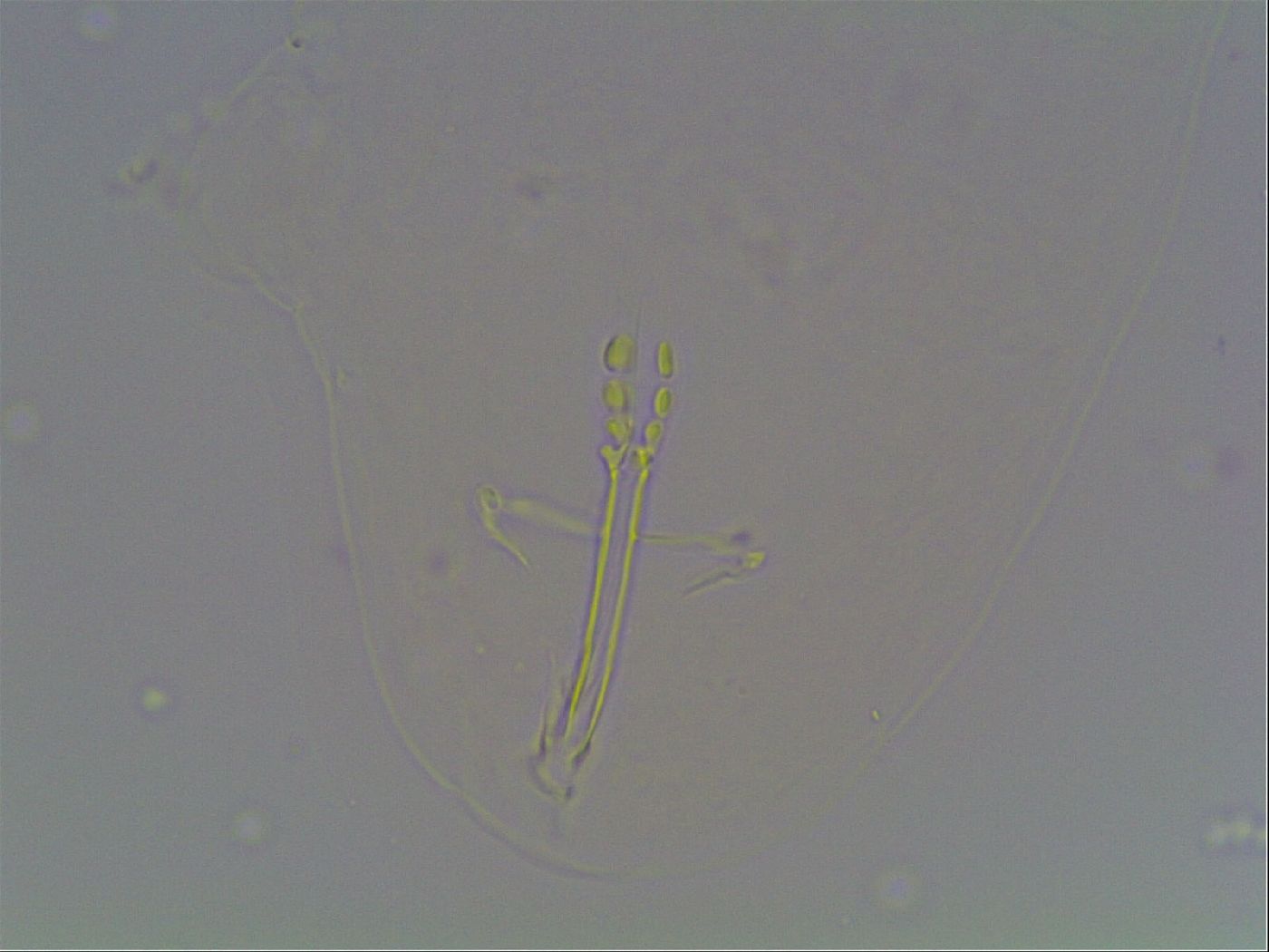 Hexapodibius pseudomicronyx image