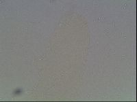 Hexapodibius pseudomicronyx image
