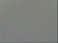Hypsibius convergens image