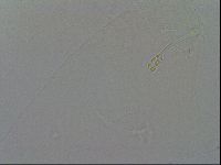 Hypsibius convergens image