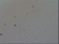 Hypsibius convergens image