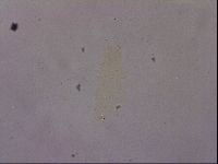Ramazzottius oberhaeuseri image