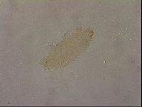 Ramazzottius oberhaeuseri image