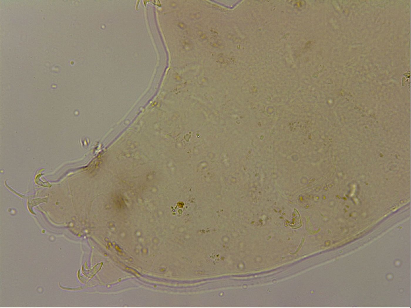 Ramazzottius oberhaeuseri image