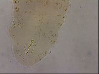 Ramazzottius oberhaeuseri image
