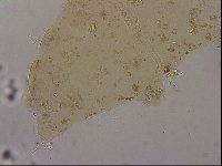 Ramazzottius oberhaeuseri image
