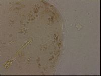 Ramazzottius oberhaeuseri image