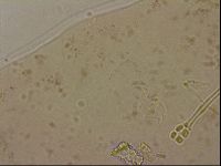 Ramazzottius oberhaeuseri image