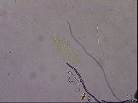 Ramazzottius oberhaeuseri image
