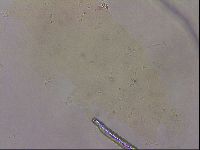 Ramazzottius oberhaeuseri image