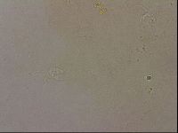 Ramazzottius oberhaeuseri image