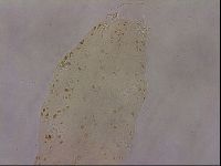 Ramazzottius oberhaeuseri image