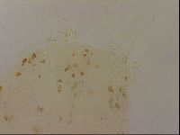 Ramazzottius oberhaeuseri image