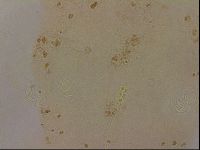 Ramazzottius oberhaeuseri image