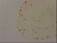 Ramazzottius oberhaeuseri image
