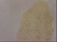 Ramazzottius oberhaeuseri image