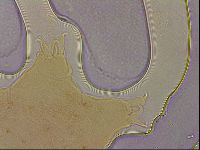 Ramazzottius oberhaeuseri image