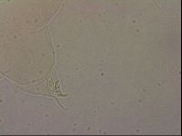 Ramazzottius oberhaeuseri image