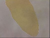 Ramazzottius oberhaeuseri image