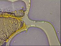 Ramazzottius oberhaeuseri image