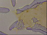 Ramazzottius oberhaeuseri image