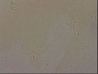 Ramazzottius oberhaeuseri image
