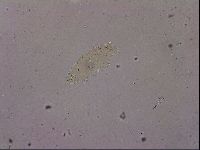 Ramazzottius oberhaeuseri image