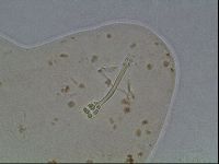 Ramazzottius oberhaeuseri image