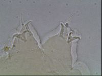Ramazzottius oberhaeuseri image