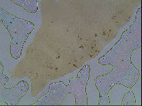 Ramazzottius oberhaeuseri image