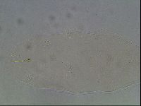 Ramazzottius oberhaeuseri image