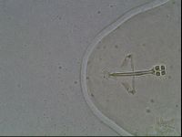 Ramazzottius oberhaeuseri image