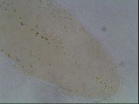 Ramazzottius oberhaeuseri image