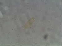 Ramazzottius oberhaeuseri image