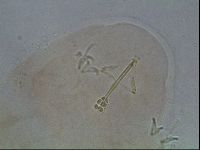 Ramazzottius oberhaeuseri image