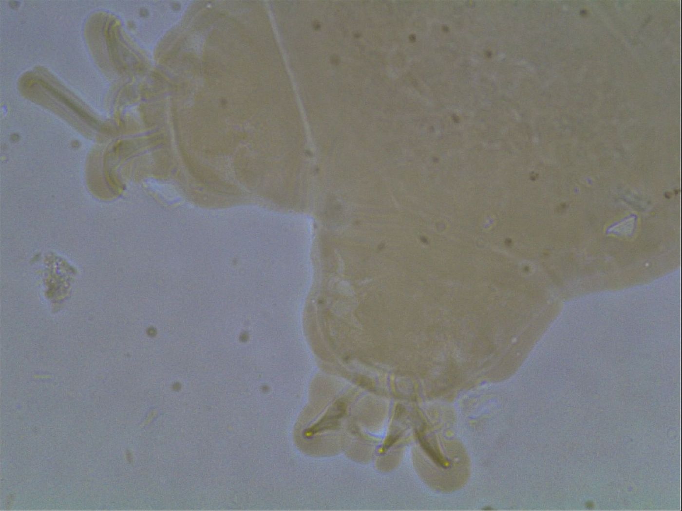 Ramazzottius oberhaeuseri image