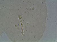 Ramazzottius oberhaeuseri image